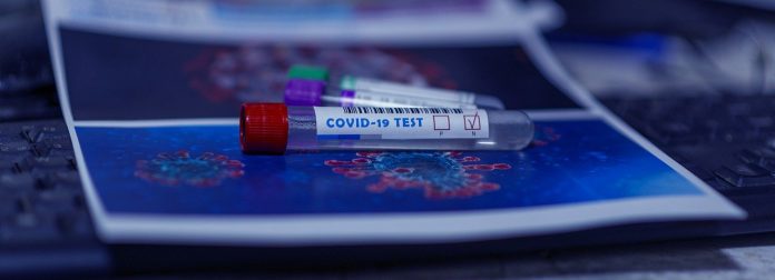 Тест-система на коронавирус